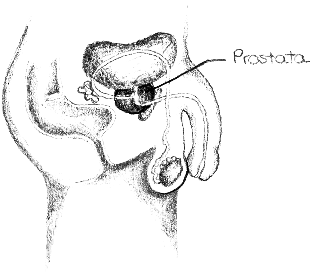 Prostata